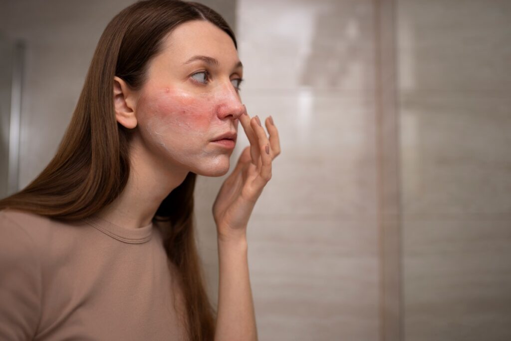 Recognizing the Differences: Hormonal VS Bacterial Acne 