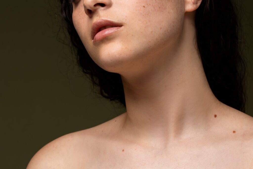 Kybella Alternatives Uncovered